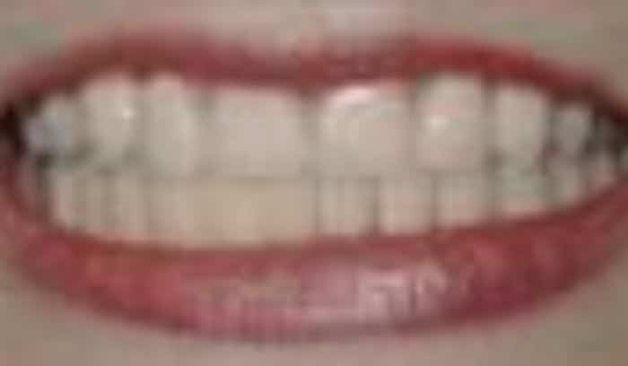 patient five after smile gallery lansdowne dentistry by design