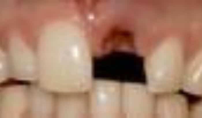 patient three before smile gallery lansdowne dentistry by design