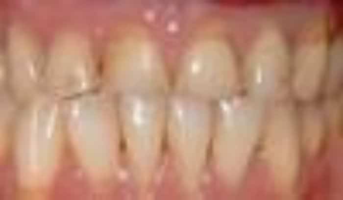 patient two before smile gallery lansdowne dentistry by design