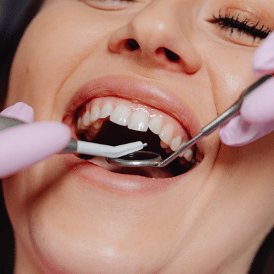 A woman getting her teeth checked at the dentist, representing professional fluoride treatment