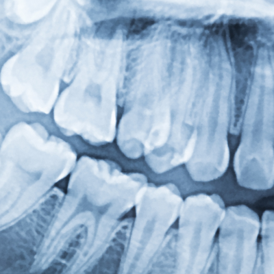 Dental X-ray showing teeth and roots, representing modern family dentistry